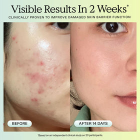 Application on skin demonstrates calming, barrier-supporting benefits during routine.