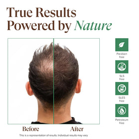 Kreyol Essence Aloe Vera soothing itchy scalp and balancing oil