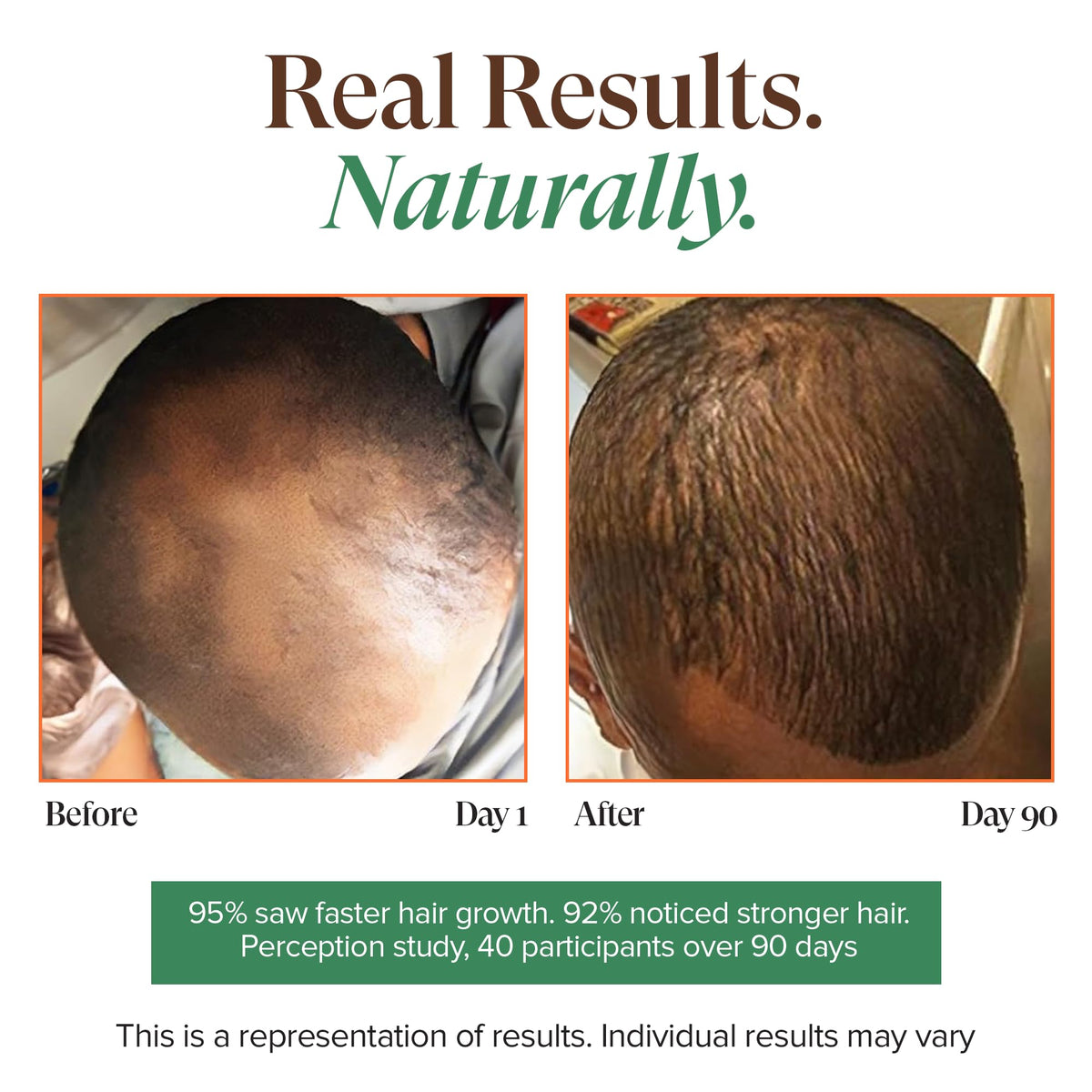 Kreyol Essence scalp application shows easy massage to boost fullness.