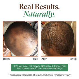 Kreyol Essence scalp application shows easy massage to boost fullness.