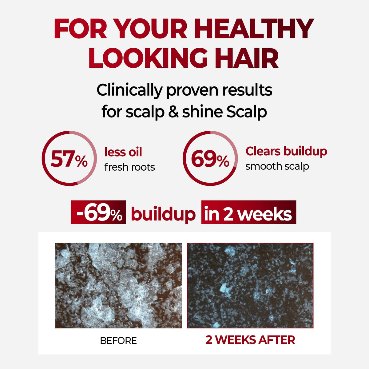 KUNDAL anti hair loss shampoo menthol splash provides cooling scalp sensation.