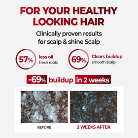 KUNDAL anti hair loss shampoo menthol splash provides cooling scalp sensation.
