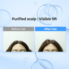 KUNDAL Shampoo foam lather close-up highlights airy texture and lightweight volume.