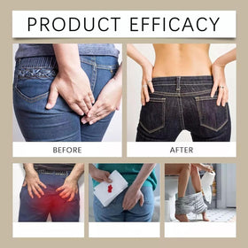 Kunnozz hemorrhoid cream formula suitable for sensitive skin