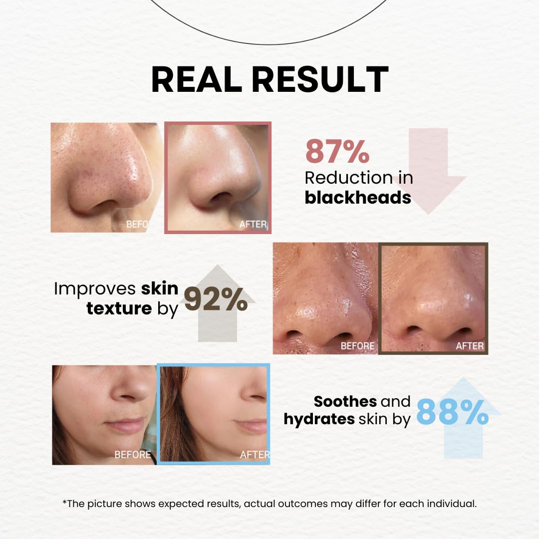 La Noubelle MPC Bubble Pore Cleanser pores minimized image suggesting refined texture