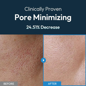 LAB BY He is_ Niacinamide focus for visible pore refinement.