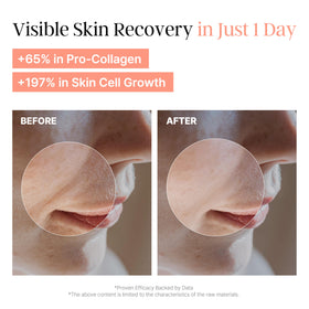 Laboreve PeachMicrobiome close-up texture highlights milky finish and quick absorption