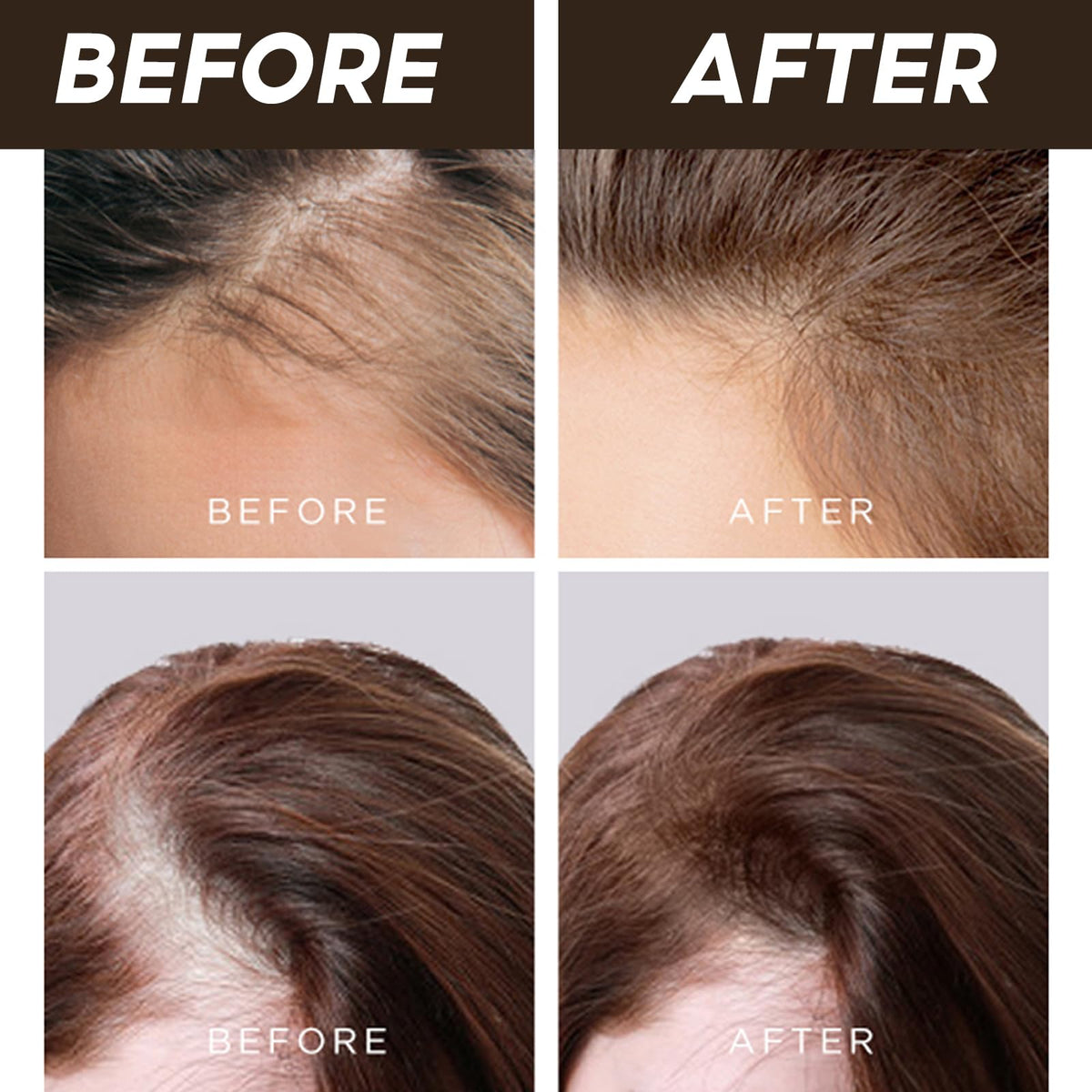 LALACHUU gray roots concealed for a fuller, seamless appearance.