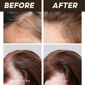 LALACHUU gray roots concealed for a fuller, seamless appearance.