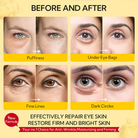 LANBENA easy-use under-eye patches ready in 10–20 minutes.