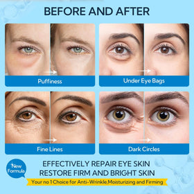 LANBENA eye-mask hydrogel closeup shows smooth, moisturized texture.
