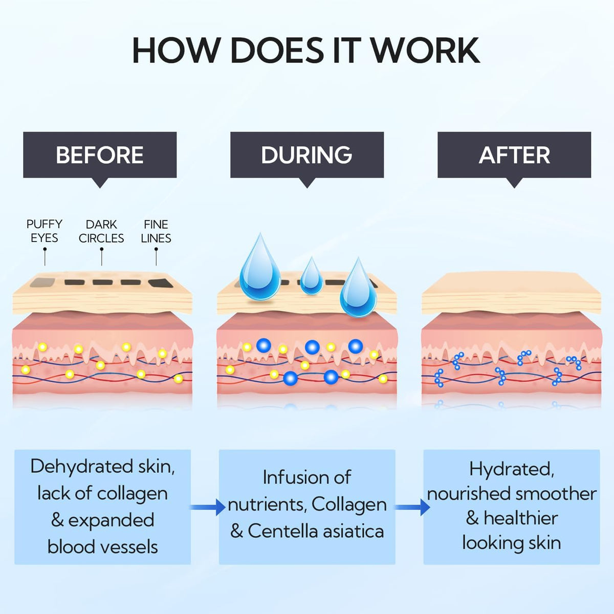 LANBENA Hydra-Gel Eye Mask applied for 10–20 minutes for quick refresh.