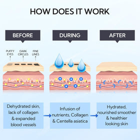 LANBENA Hydra-Gel Eye Mask applied for 10–20 minutes for quick refresh.