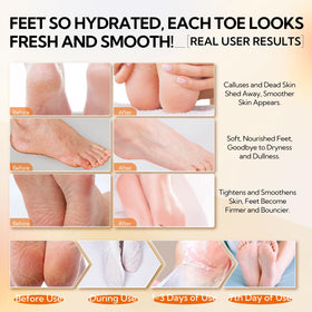 LANBENA before-after soft-feet demonstrates visible improvements after use.