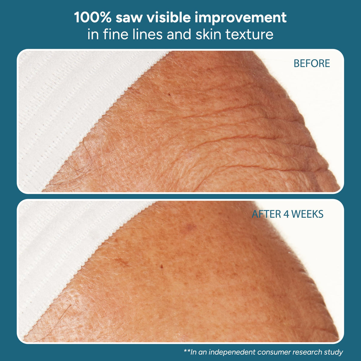 Lancer The Method Nourish hyaluronic acid in action for lasting hydration.