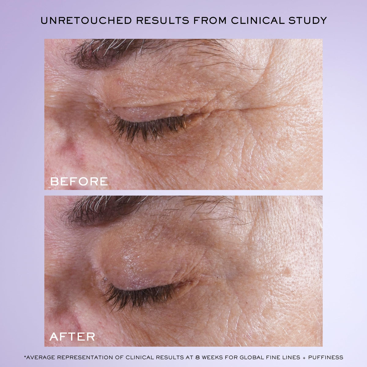 Lancôme Rénergie H.C.F. Triple Serum Eye tube-angle shot highlights brighter under-eye contour.
