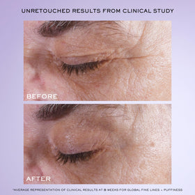 Lancôme Rénergie H.C.F. Triple Serum Eye tube-angle shot highlights brighter under-eye contour.