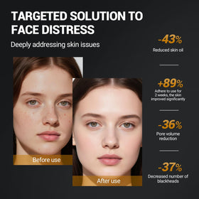 LANGULLCI weekly use promotes balanced skin and reduced oil shine