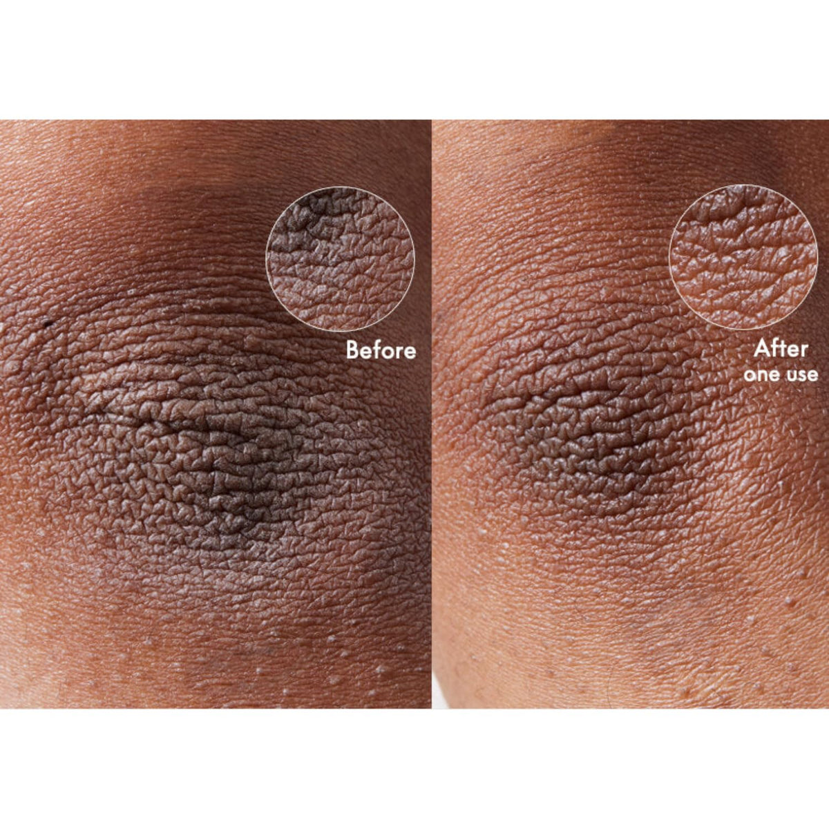 Lanolips 101 shea butter and vitamin E nourishes skin moisture