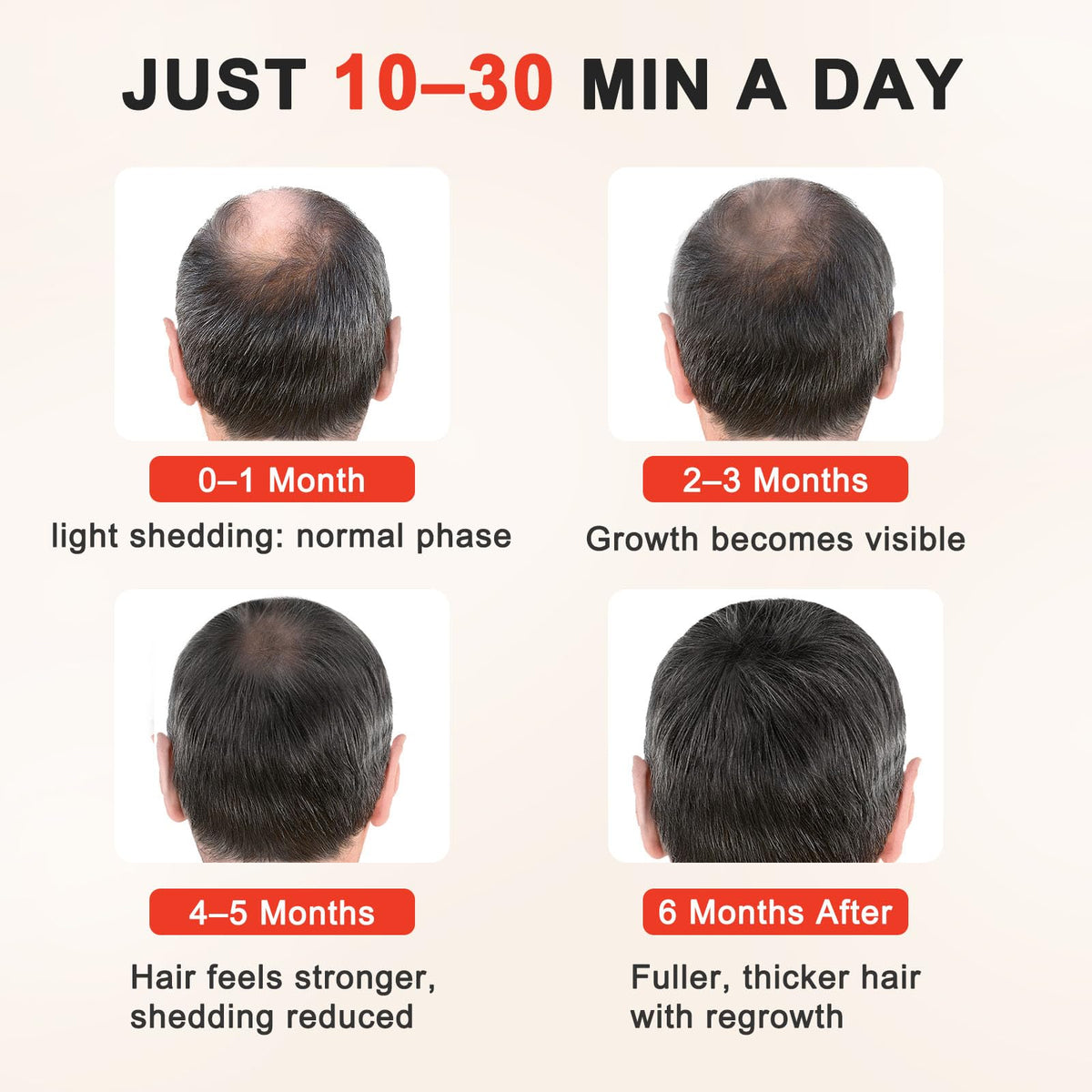 Laser Hair Growth Cap wired connection to controller for easy use