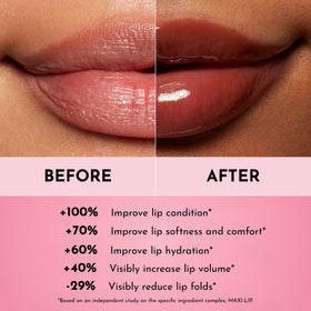 LAWLESS Forget The Filler gloss on lips delivers glass-like shine and definition.