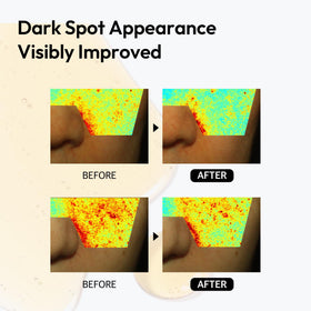 LAYERLAB close-up shows even-toned appearance after use.