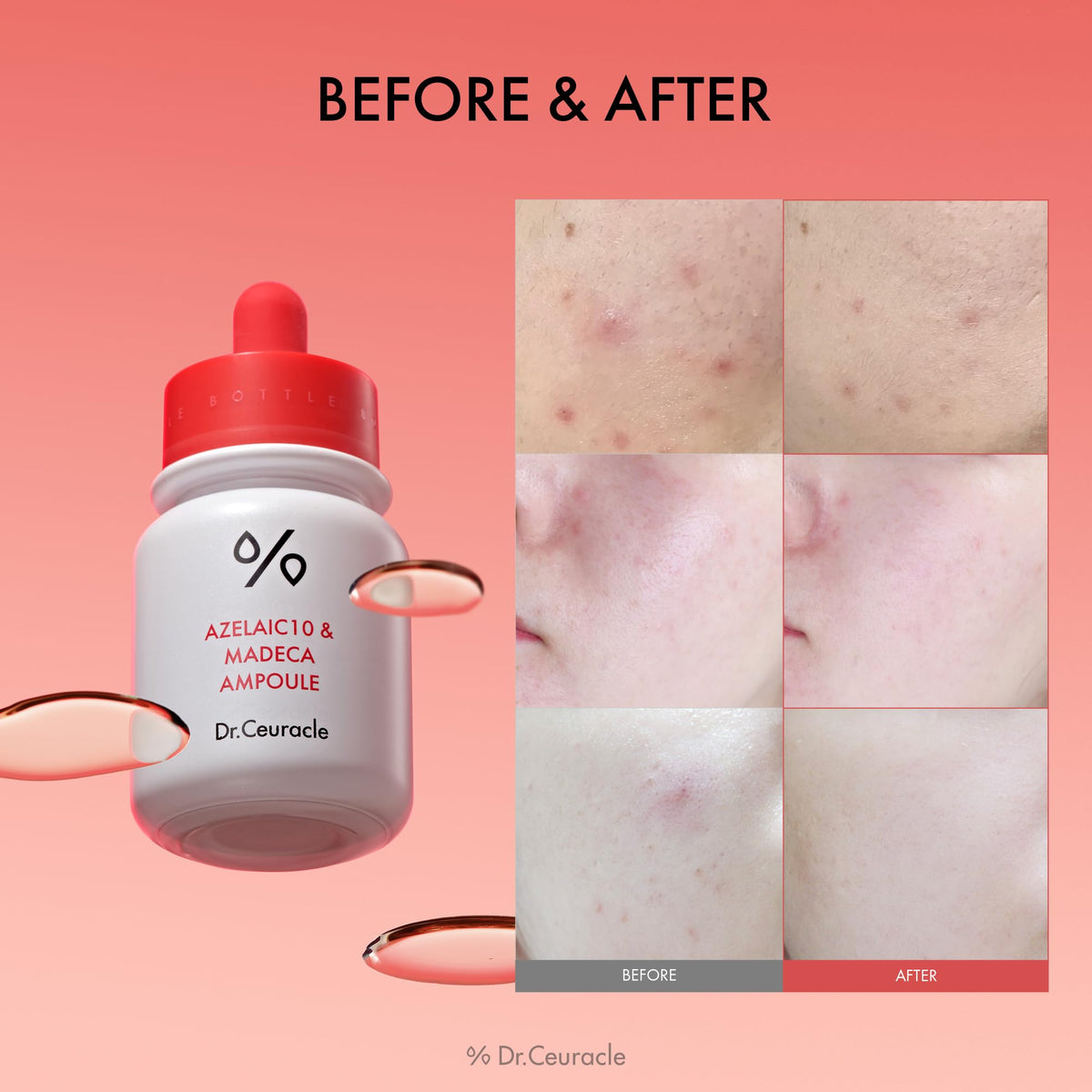 Leegeehaam Dr.Ceuracle azelaic 10% ampoule ingredients scene highlighting Madecassoside calming properties
