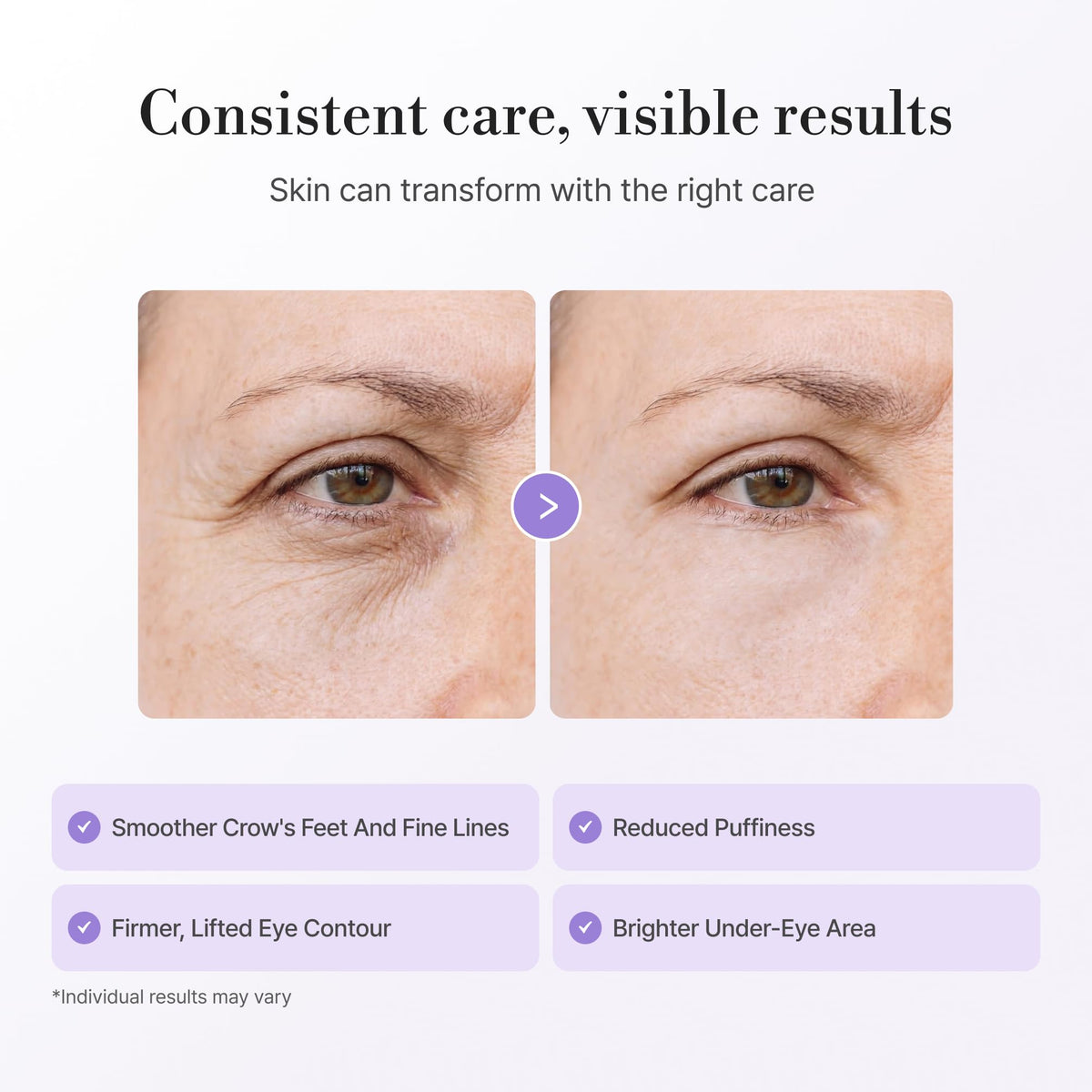 Lepique Peptide-Matrix Eye Cream under-eye use showcasing hydration and glow