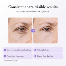 Lepique Peptide-Matrix Eye Cream under-eye use showcasing hydration and glow