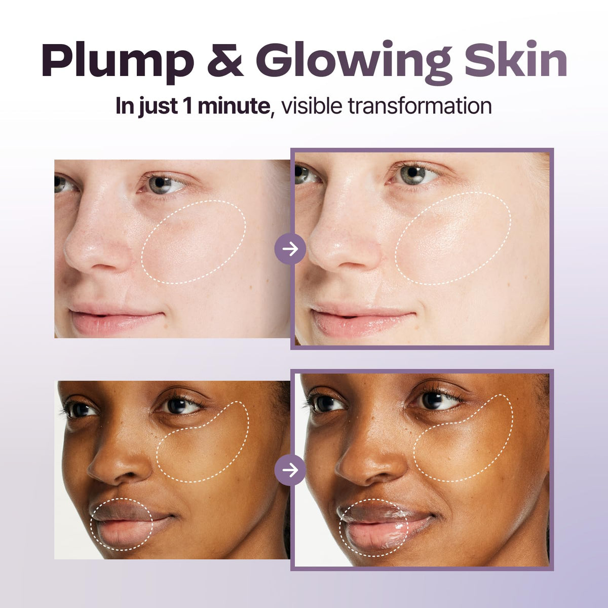 LG Pra.L Superform Galvanic Booster Mystic White close-up of red LED light energizing skin