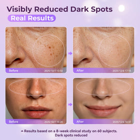 LGUYO dark spot remover on skin during application for even tone