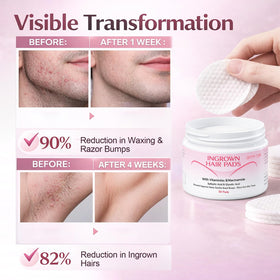 LHOPEBK Nature hydrating pads for the face replenish moisture during exfoliation.
