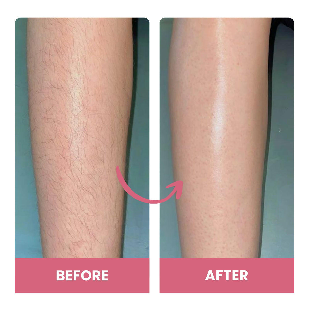 Soft, hydrated skin after Bare Basics use with no stubble.