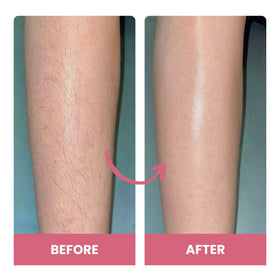 Soft, hydrated skin after Bare Basics use with no stubble.