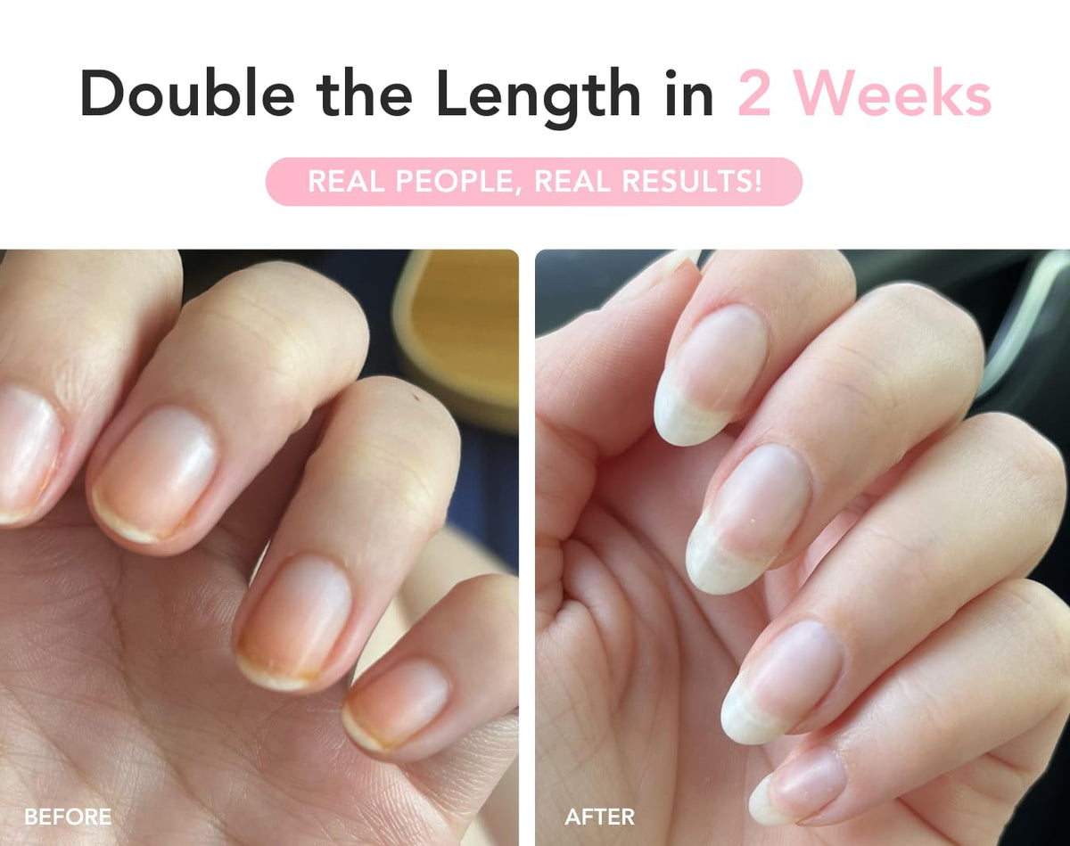 Before and after nails with UltraGrow growth progress.