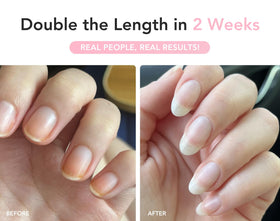 Before and after nails with UltraGrow growth progress.
