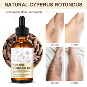 Liefiet Cyperus Rotundus Oil after hair removal use applying on skin.