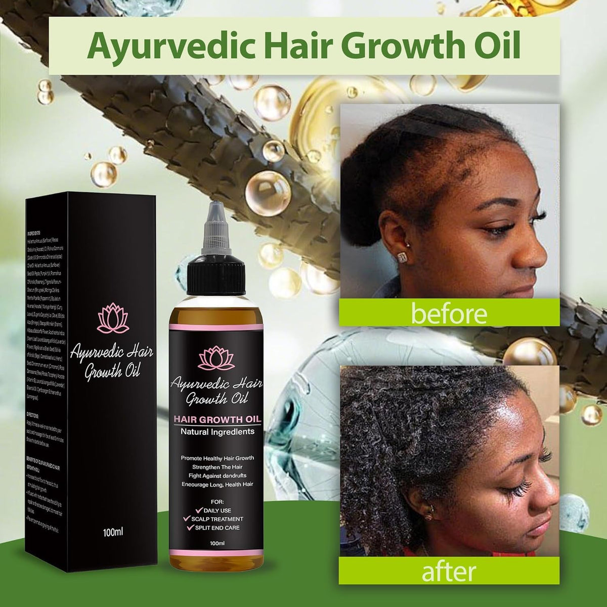 Lifewitqueenp dropper tip applying oil to the scalp for nourishment.