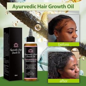Lifewitqueenp dropper tip applying oil to the scalp for nourishment.