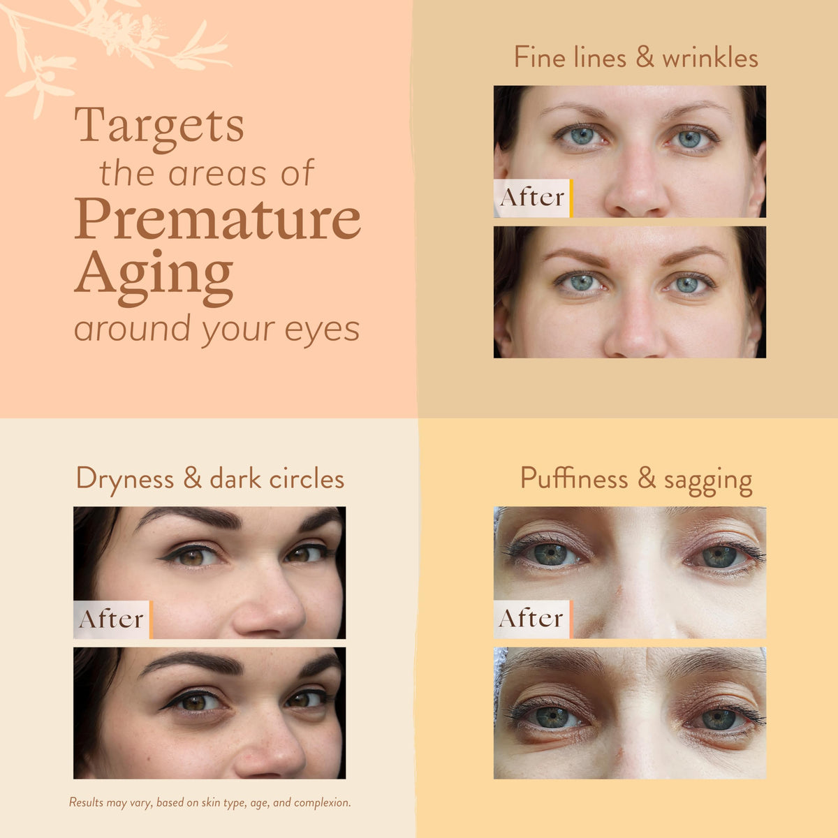Cooling feel of the eye cream may help with under-eye puffiness.
