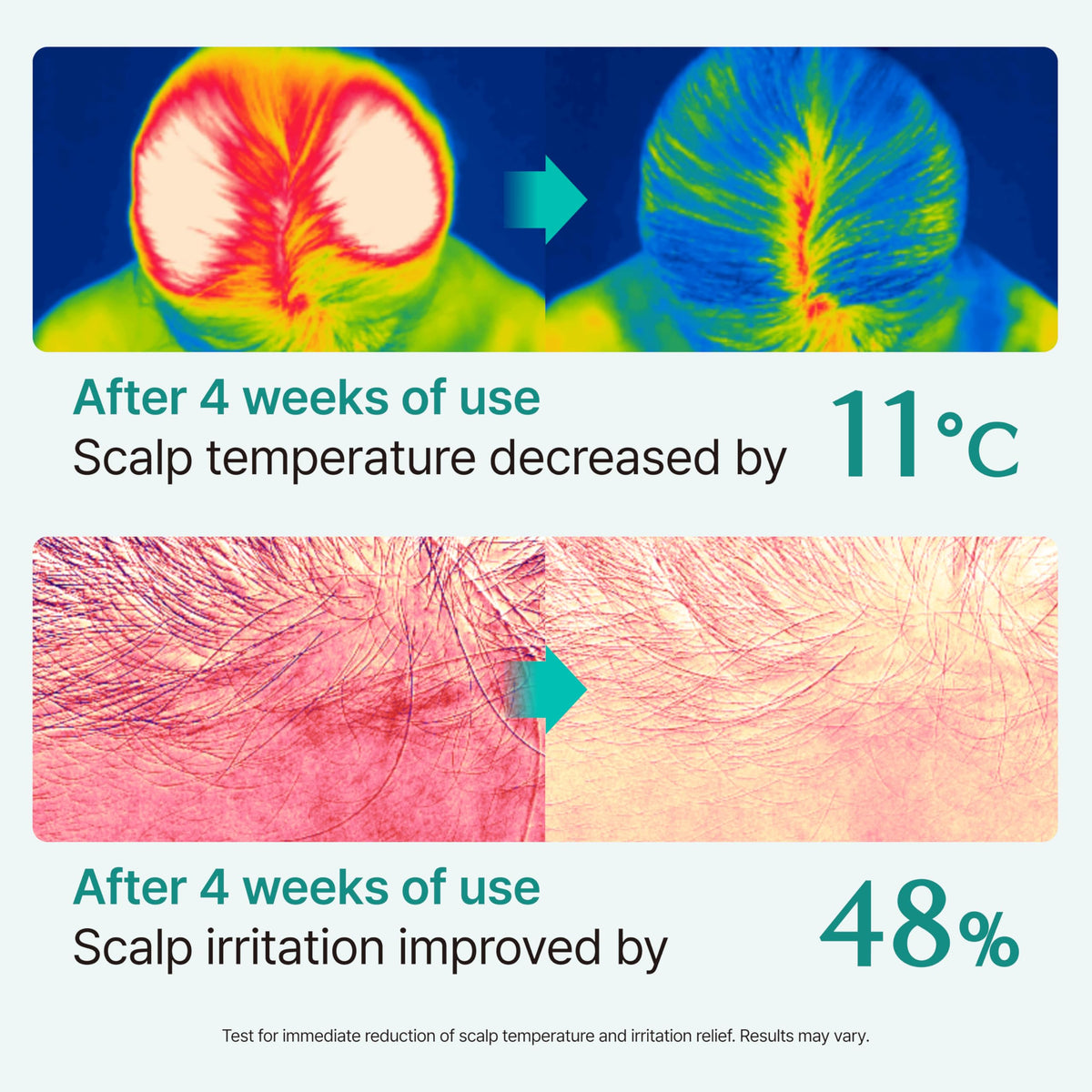 lilyeve SCALPTURN exosome technology graphic hinting at stronger roots and fuller look