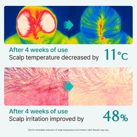 lilyeve SCALPTURN exosome technology graphic hinting at stronger roots and fuller look
