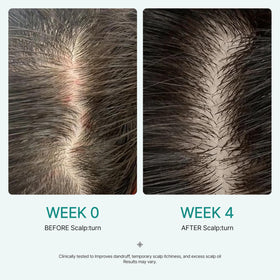 lilyeve SCALPTURN serum drops on scalp for calm hydration on dry itchy areas