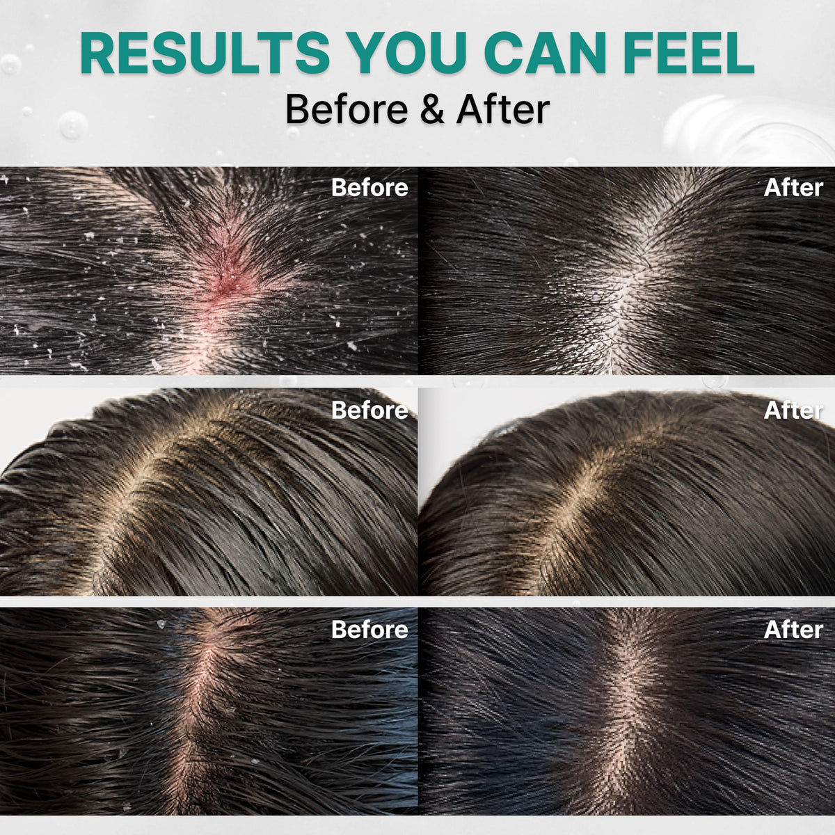 lilyeve SCALPTURN Shampoo ingredients page showing cica PDRN for calm scalp