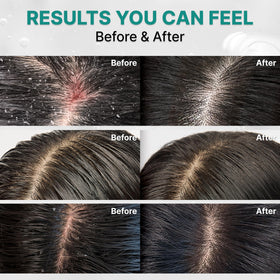 lilyeve SCALPTURN Shampoo ingredients page showing cica PDRN for calm scalp