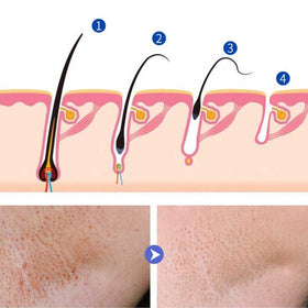 Applying LINEDSON cream to the face for smooth, hydrated skin