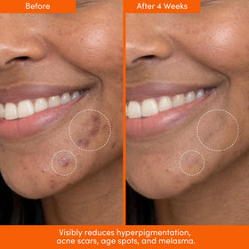 The jelly-like texture of Lion Pose serum on the skin.