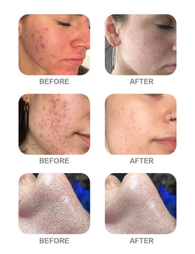 Lipepper AS1 SA2 AO3 spa-treatment-scene communicates benefits of deeper cleansing and hydration.
