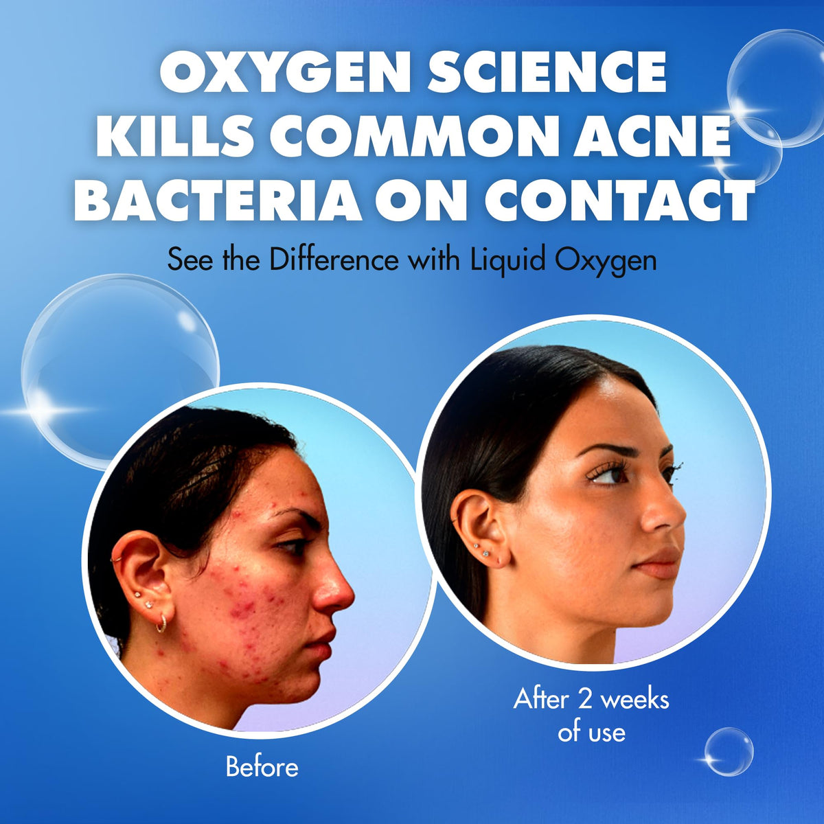 Liquid Oxygen hydrating moisturizer SPF 30 provides light hydration.