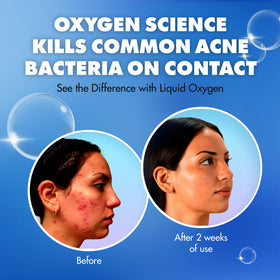 Liquid Oxygen hydrating moisturizer SPF 30 provides light hydration.